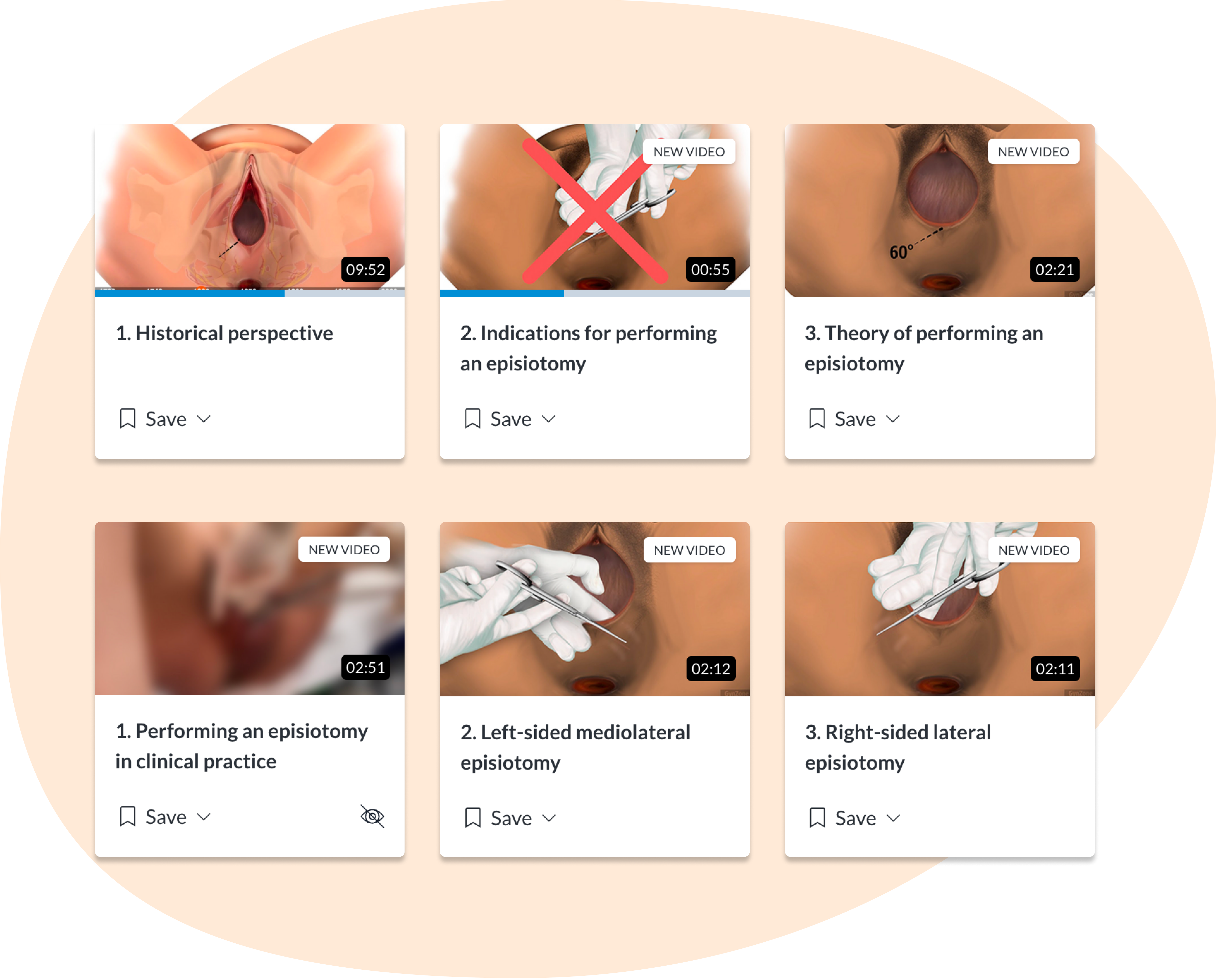 Assessment of healing in labial tears