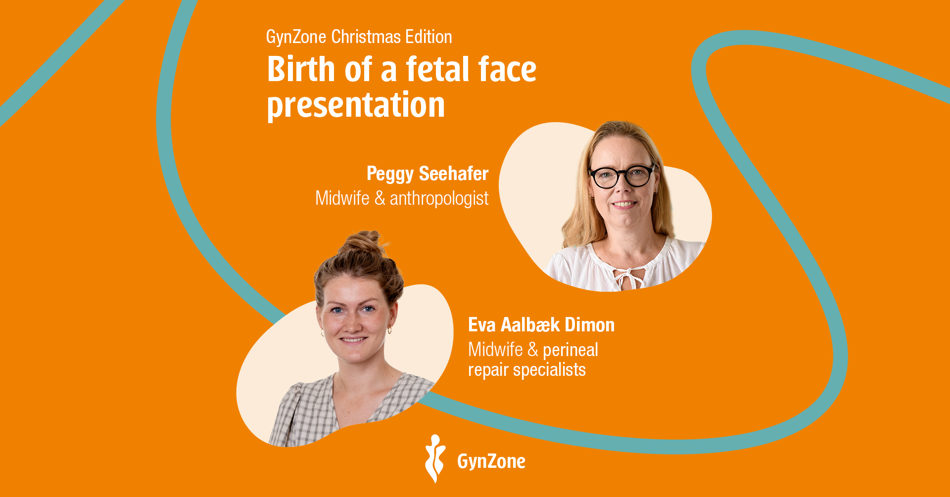 FB_event_241101_fetal-face-presentation